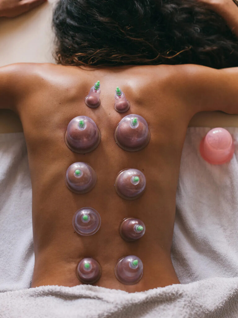 decontratturante sportivo cupping